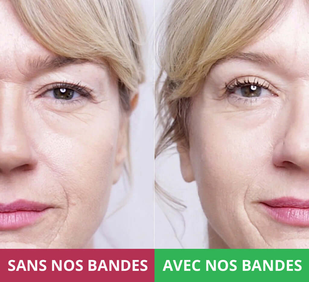 Les Bandes Rehaussantes Invisibles de Blushy
