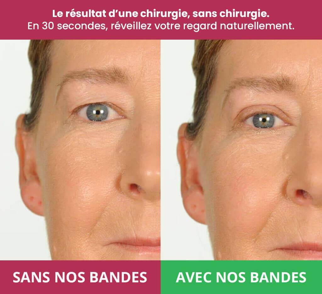 Bandes Rehaussantes Invisibles Blushy