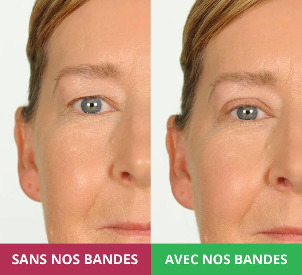 Les Bandes Rehaussantes Invisibles de Blushy